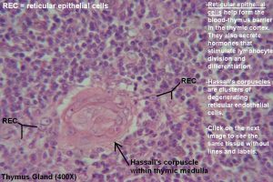 Thymus – Tutorial – Histology Atlas for Anatomy and Physiology