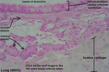 Bronchi and Bronchioles – Tutorial – Histology Atlas for Anatomy and ...