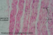 Peripheral Nerve – Tutorial – Histology Atlas for Anatomy and Physiology