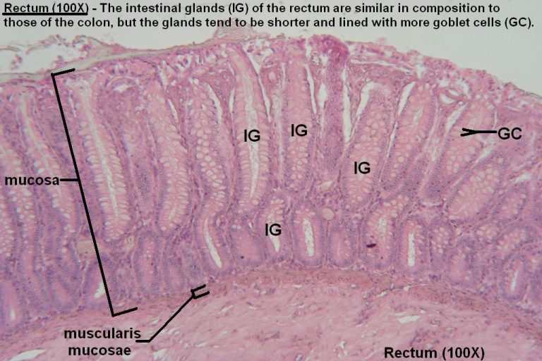 Large Intestine – Tutorial – Histology Atlas for Anatomy and Physiology