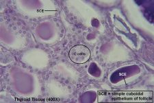 Thyroid-Parathyroid – Tutorial – Histology Atlas for Anatomy and Physiology