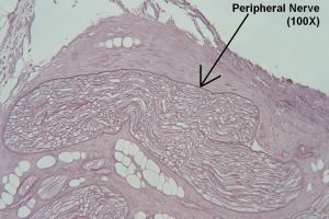 Peripheral Nerve – Tutorial – Histology Atlas for Anatomy and Physiology