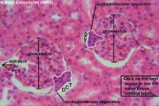 Kidney – Tutorial – Histology Atlas for Anatomy and Physiology