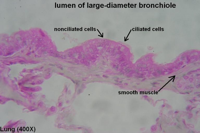 Bronchi and Bronchioles – Tutorial – Histology Atlas for Anatomy and ...