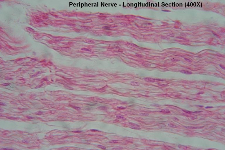 Peripheral Nerve – Tutorial – Histology Atlas for Anatomy and Physiology